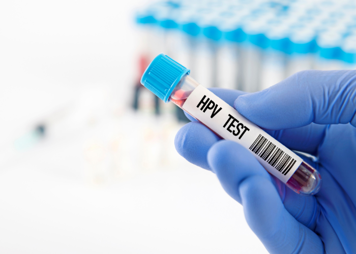 בדיקת HPV
